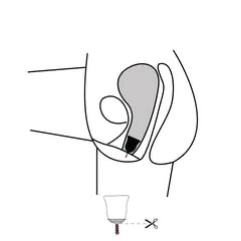 <p>Composée d’une matière très souple et malléable, la coupe menstruelle se porte beaucoup plus bas qu’un tampon et se place directement sous le col de l’utérus. Une fois bien positionnée, il n'y a aucun risque de fuites.</p><p>La coupe menstruelle peut se positionner de différentes façons en fonction de chaque anatomie. Elle peut être complètement à l'intérieur ou la tige peut légèrement sortir. Cela n’a pas d’importante. La cup, une fois insérée ne doit absolument pas vous gêner.</p><p>Si la coupe menstruelle est complètement à l'intérieur, la tige permet de la faire descendre plus facilement au moment du retrait. En tirant légèrement dessus, on parvient à atteindre la base de la cup afin de la pincer pour ensuite la retirer. </p><p>Si la coupe menstruelle se positionne très haut - ne panique pas - c'est tout à fait normal, il suffit juste de la pousser avec tes muscles vaginaux pour la faire redescendre.</p> <p>Composée d’une matière très souple et malléable, la coupe menstruelle se porte beaucoup plus bas qu’un tampon et se place directement sous le col de l’utérus. Une fois bien positionnée, il n'y a aucun risque de fuites.</p><p>La coupe menstruelle peut se positionner de différentes façons en fonction de chaque anatomie. Elle peut être complètement à l'intérieur ou la tige peut légèrement sortir. Cela n’a pas d’importante. La cup, une fois insérée ne doit absolument pas vous gêner.</p><p>Si la coupe menstruelle est complètement à l'intérieur, la tige permet de la faire descendre plus facilement au moment du retrait. En tirant légèrement dessus, on parvient à atteindre la base de la cup afin de la pincer pour ensuite la retirer. </p><p>Si la coupe menstruelle se positionne très haut - ne panique pas - c'est tout à fait normal, il suffit juste de la pousser avec tes muscles vaginaux pour la faire redescendre.</p>